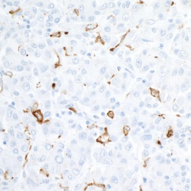 CD163 Antibody in Immunohistochemistry (Paraffin) (IHC (P))
