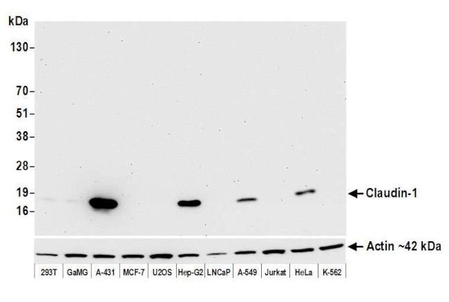 Claudin 1 Recombinant Monoclonal Antibody (BLR094G) (MA5-44379)