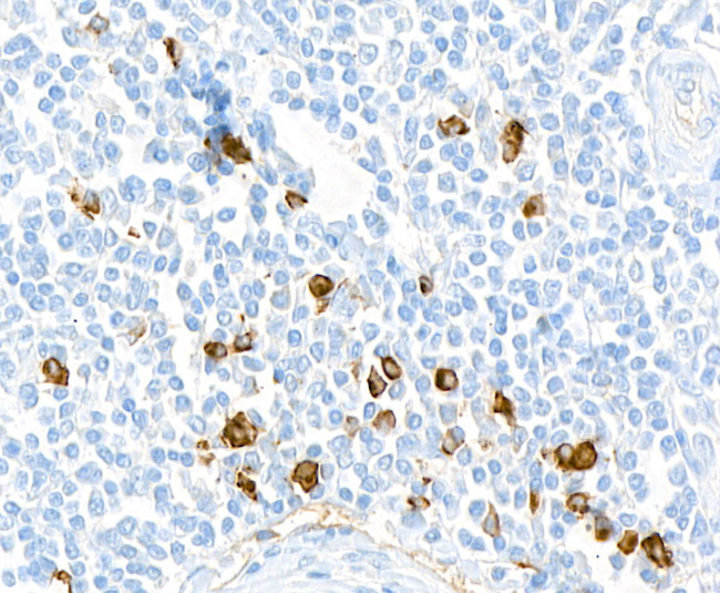 Human IgG4 Antibody in Immunohistochemistry (Paraffin) (IHC (P))