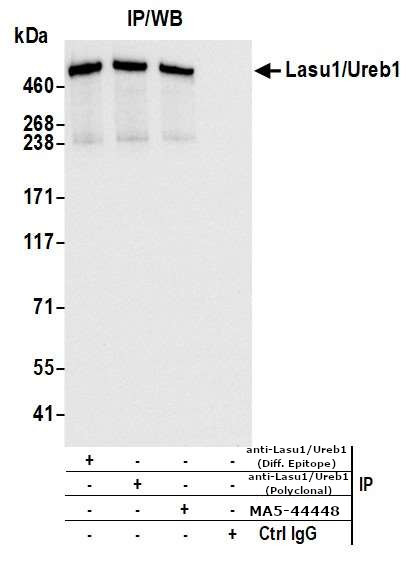 HUWE1 Recombinant Monoclonal Antibody (BLR129H) (MA5-44447)