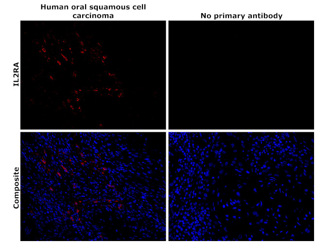 CD25 Antibody in Immunohistochemistry (Paraffin) (IHC (P))