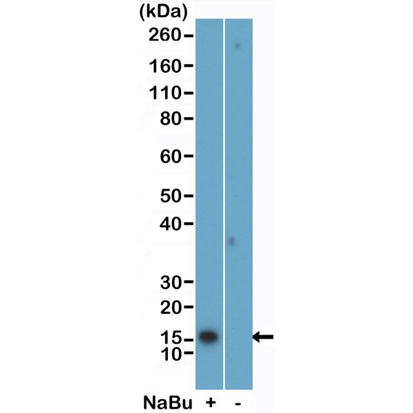 H2BK5ac Antibody in Western Blot (WB)