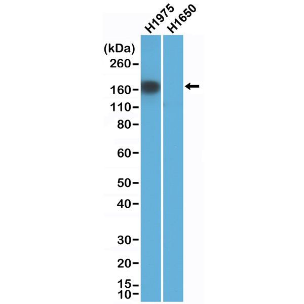 EGFR (L858R Mutant) Antibody in Western Blot (WB)