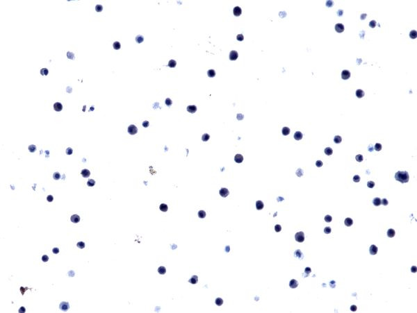EGFR (L858R Mutant) Antibody in Immunocytochemistry (ICC/IF)