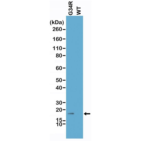 H3.3 G34R oncohistone mutant Antibody in Western Blot (WB)