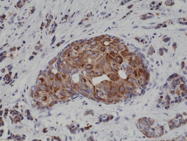 Cytokeratin 18 Antibody in Immunohistochemistry (Paraffin) (IHC (P))