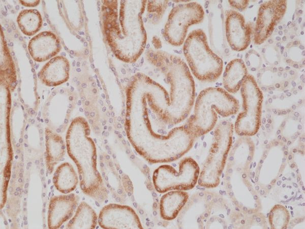 AMACR Antibody in Immunohistochemistry (Paraffin) (IHC (P))