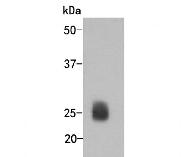 Lambda light chain Antibody in Western Blot (WB)
