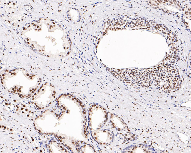 Androgen Receptor Recombinant Monoclonal Antibody (PO00-29) (MA5-44654)