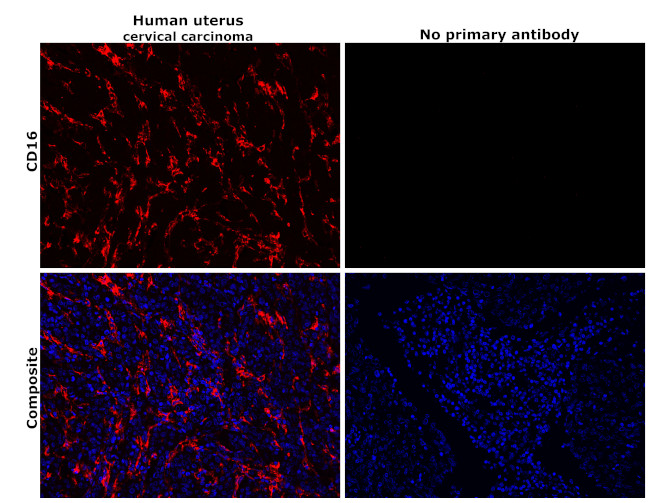 CD16 Antibody in Immunohistochemistry (Paraffin) (IHC (P))