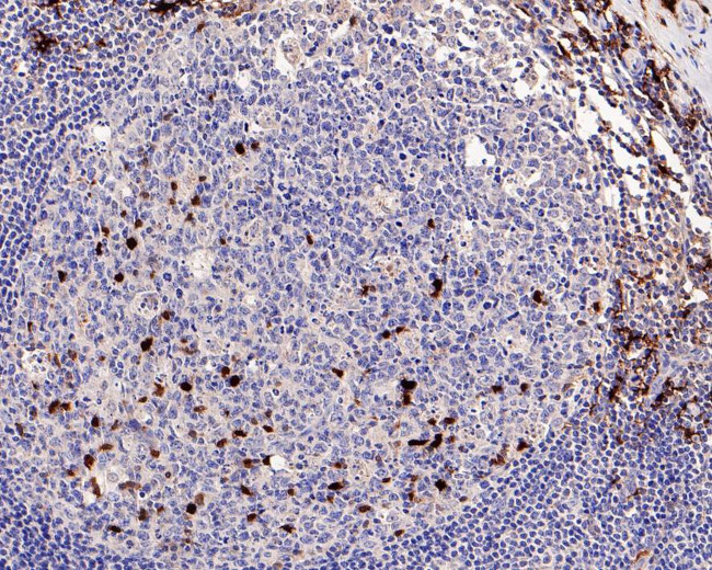 Factor XIII A Antibody in Immunohistochemistry (Paraffin) (IHC (P))
