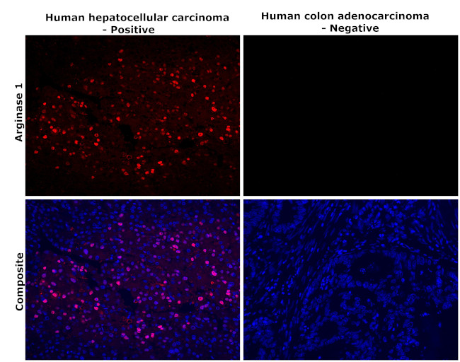 Arginase 1 Antibody in Immunohistochemistry (Paraffin) (IHC (P))