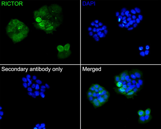 RICTOR Antibody in Immunocytochemistry (ICC/IF)