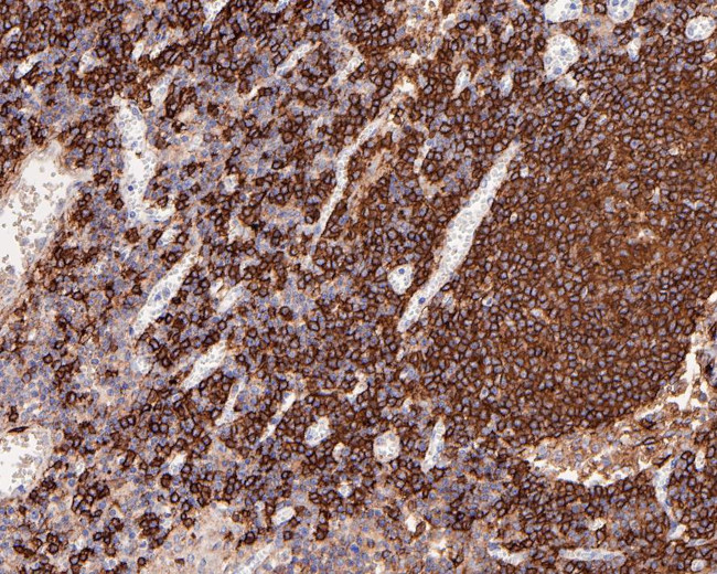 CD20 Antibody in Immunohistochemistry (Paraffin) (IHC (P))