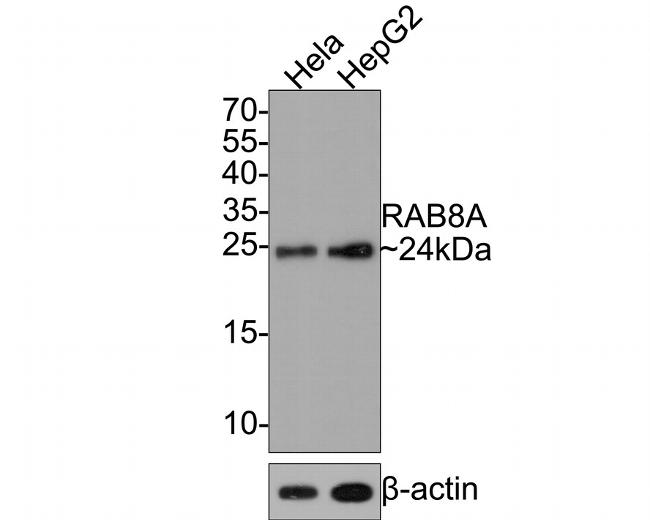 RAB8A Antibody in Western Blot (WB)