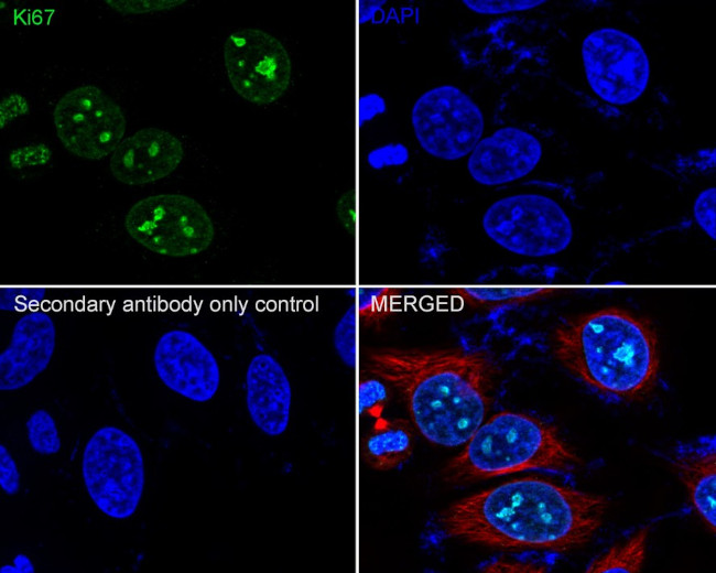 Ki-67 Antibody in Immunocytochemistry (ICC/IF)