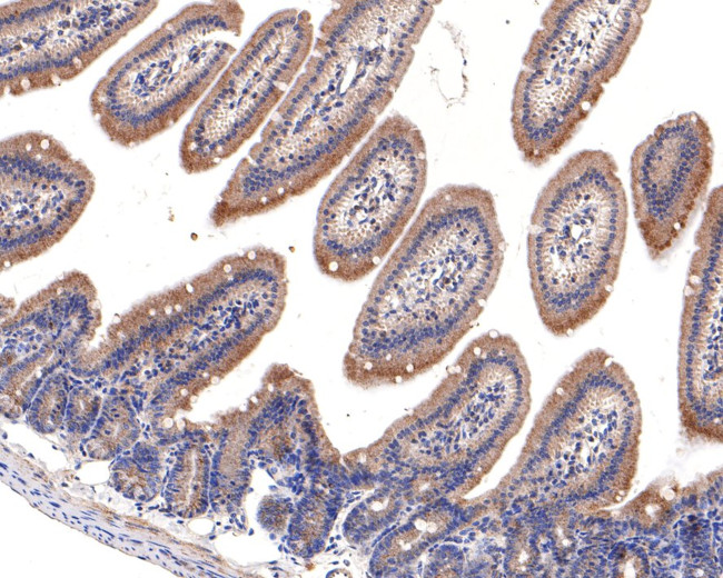 TMEM192 Antibody in Immunohistochemistry (Paraffin) (IHC (P))