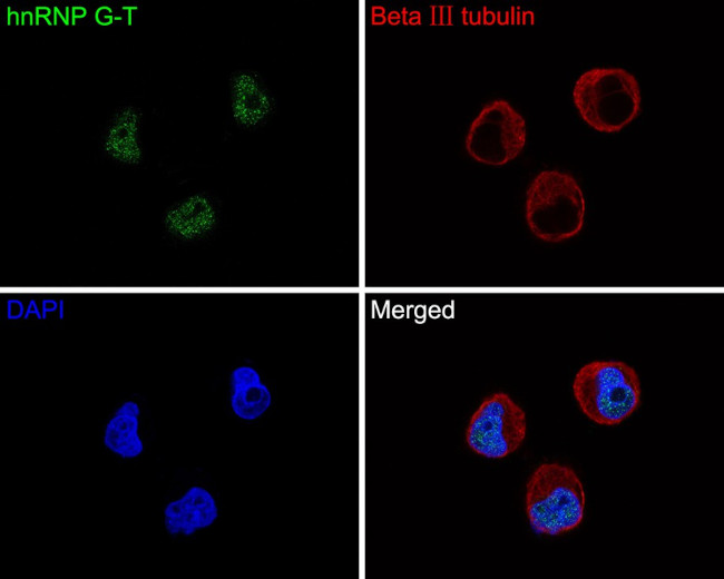 RBMXL2 Antibody in Immunocytochemistry (ICC/IF)