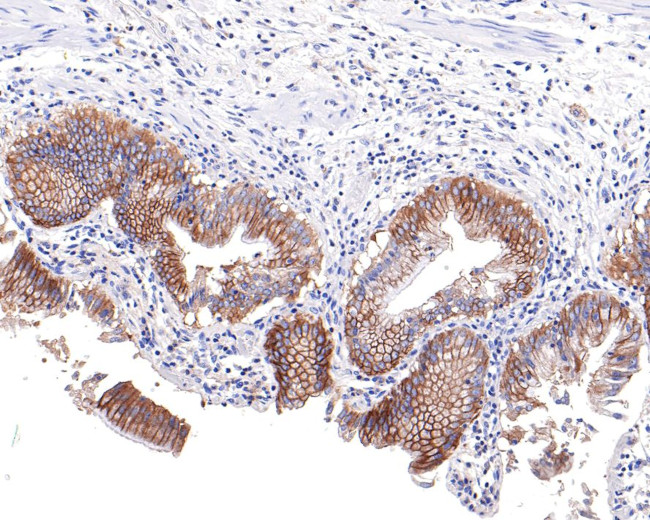 IQGAP2 Antibody in Immunohistochemistry (Paraffin) (IHC (P))