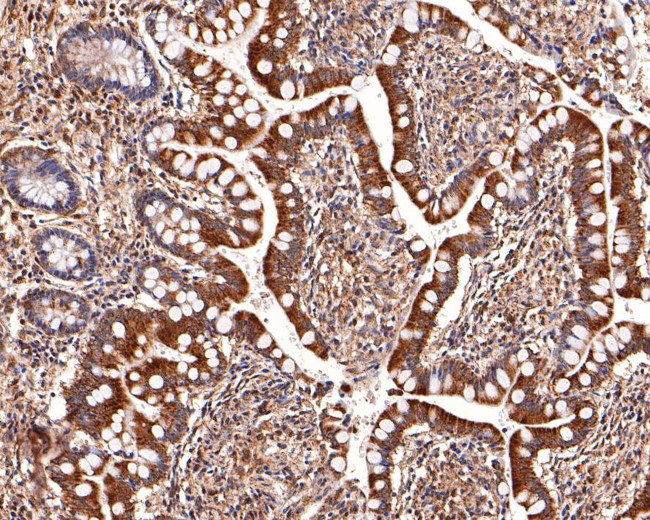 MST4 Antibody in Immunohistochemistry (Paraffin) (IHC (P))