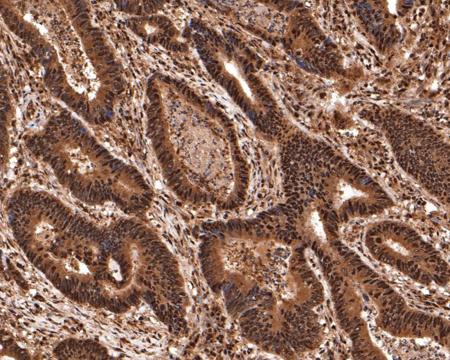 PRPF31 Antibody in Immunohistochemistry (Paraffin) (IHC (P))
