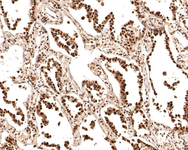 TCEA1 Antibody in Immunohistochemistry (Paraffin) (IHC (P))