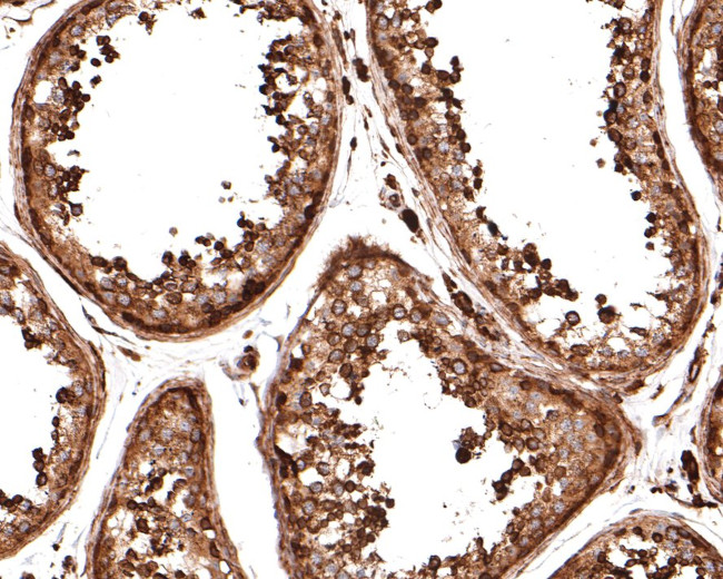 ATE1 Antibody in Immunohistochemistry (Paraffin) (IHC (P))