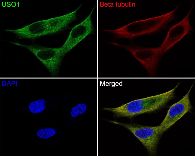 VDP Antibody in Immunocytochemistry (ICC/IF)