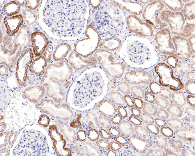 TSFM Antibody in Immunohistochemistry (Paraffin) (IHC (P))
