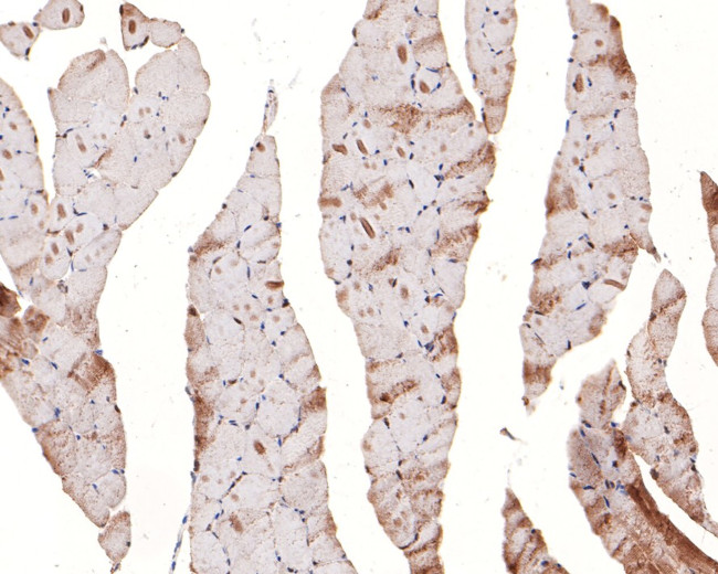 UFD1L Antibody in Immunohistochemistry (Paraffin) (IHC (P))