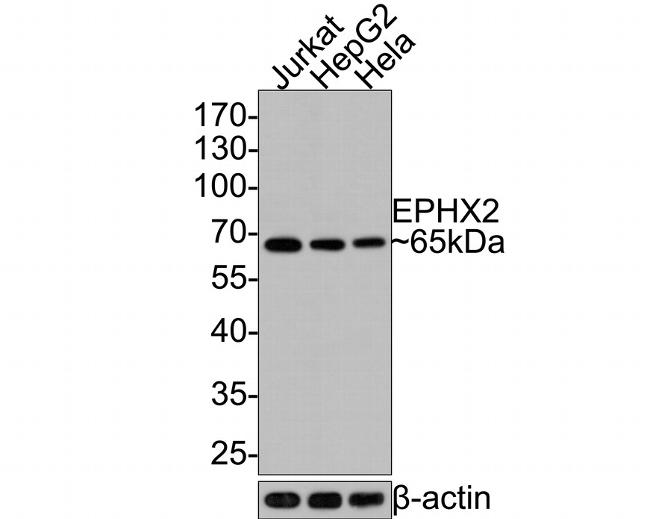 EPHX2 Antibody in Western Blot (WB)