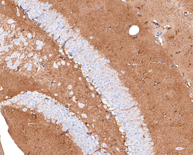 Septin-8 Antibody in Immunohistochemistry (Paraffin) (IHC (P))