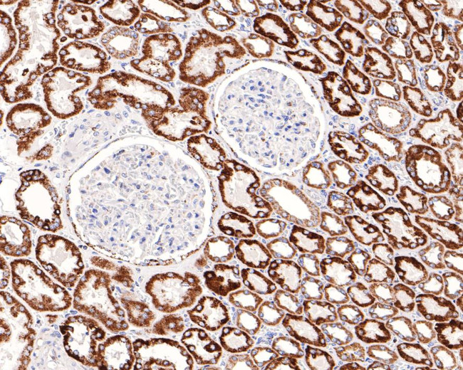Adenylate Kinase 2 Antibody in Immunohistochemistry (Paraffin) (IHC (P))