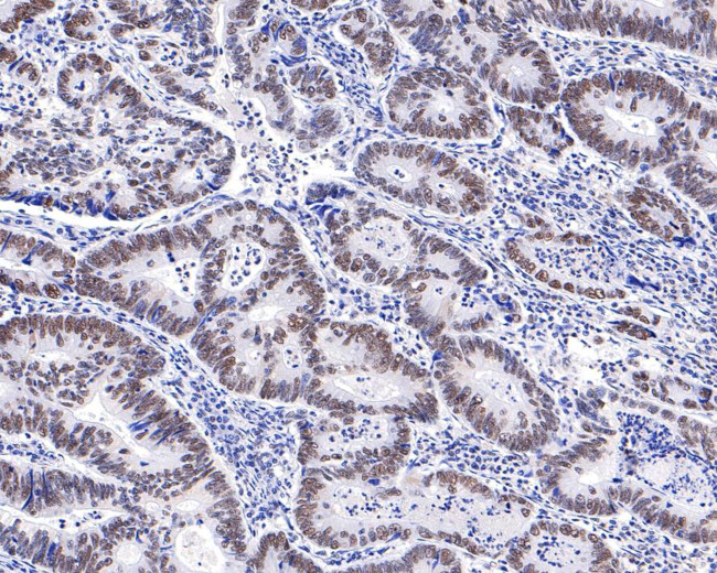 PPM1G Antibody in Immunohistochemistry (Paraffin) (IHC (P))