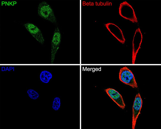 PNK Antibody in Immunocytochemistry (ICC/IF)