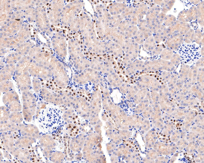 ADSS Antibody in Immunohistochemistry (Paraffin) (IHC (P))