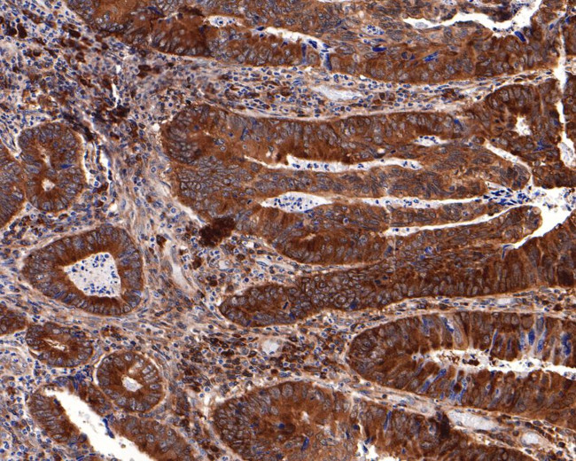 Oncostatin M Antibody in Immunohistochemistry (Paraffin) (IHC (P))