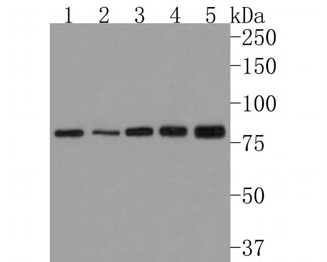 TRIP10 Antibody in Western Blot (WB)