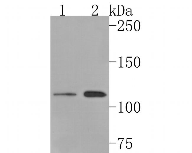 SPINK5 Antibody in Western Blot (WB)