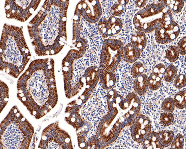 SSTR3 Antibody in Immunohistochemistry (Paraffin) (IHC (P))