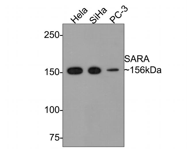 ZFYVE9 Antibody in Western Blot (WB)