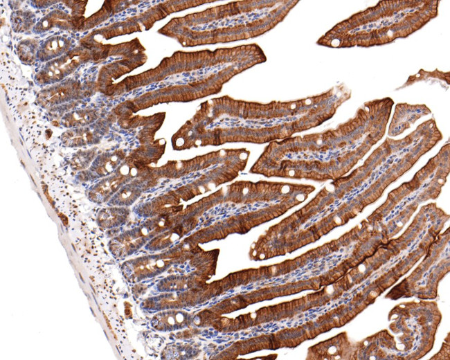 GNA13 Antibody in Immunohistochemistry (Paraffin) (IHC (P))
