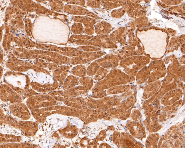 UBE2L3 Antibody in Immunohistochemistry (Paraffin) (IHC (P))
