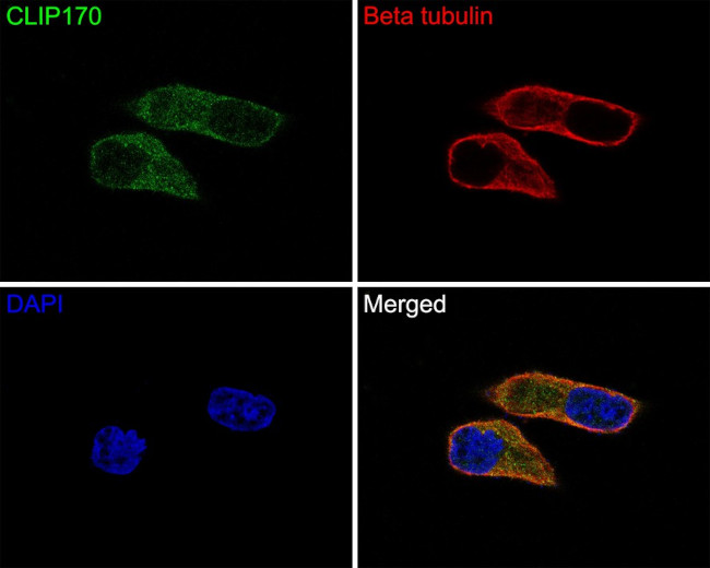 CLIP1 Antibody in Immunocytochemistry (ICC/IF)
