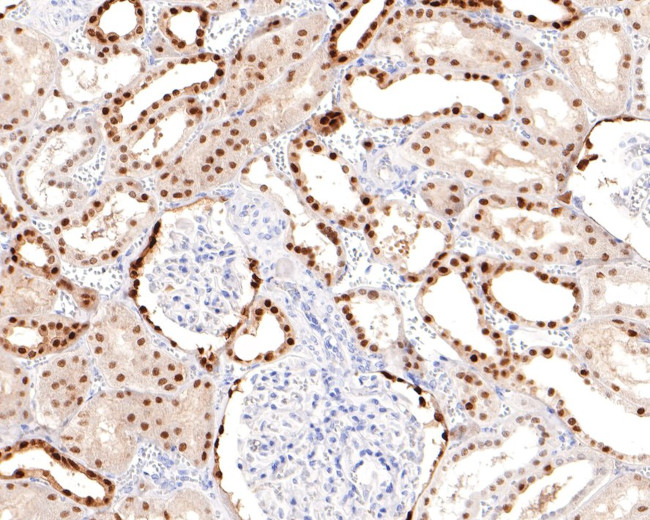 PAX8 Antibody in Immunocytochemistry (ICC/IF)