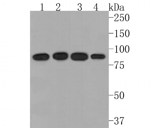 TRPV5 Antibody in Western Blot (WB)