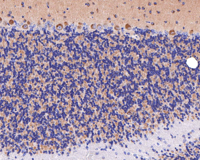 STX16 Antibody in Immunohistochemistry (Paraffin) (IHC (P))