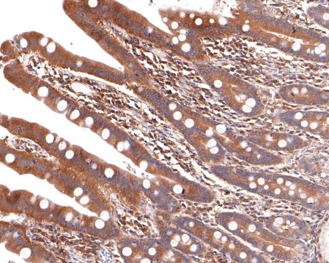 ALDH16A1 Antibody in Immunohistochemistry (Paraffin) (IHC (P))