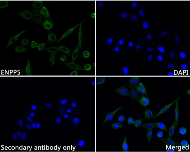 ENPP5 Antibody in Immunocytochemistry (ICC/IF)