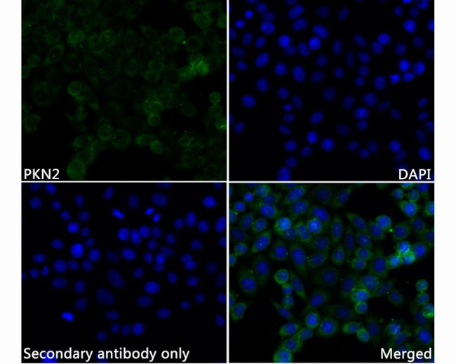 PKN2 Antibody in Immunocytochemistry (ICC/IF)